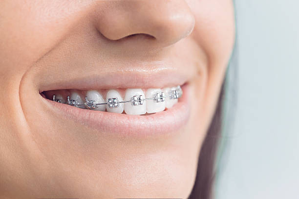 Best Veneers and Lumineers  in Poteet, TX